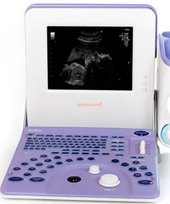 Сдам в аренду узи аппараты.