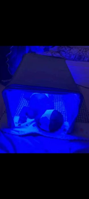 Фотолампа (лампа) от желтухи  для новорожденных.  1500 тг в сутки