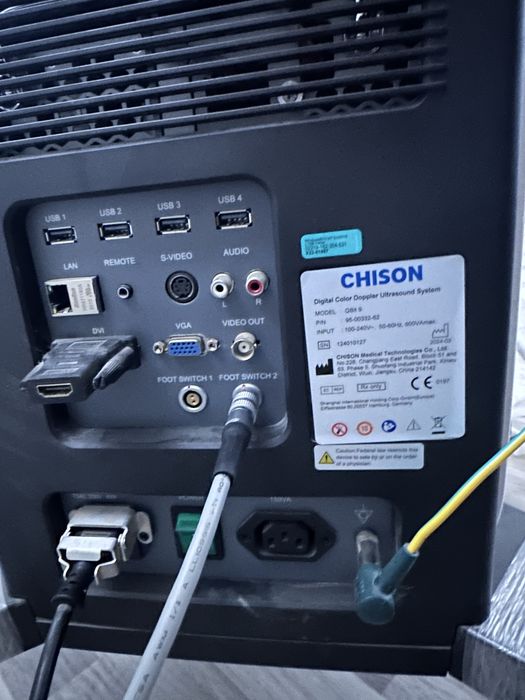 УЗИ апарат chison q bit 9