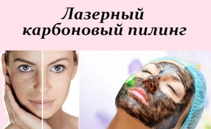 Карбоновый пилинг,7000  омоложение