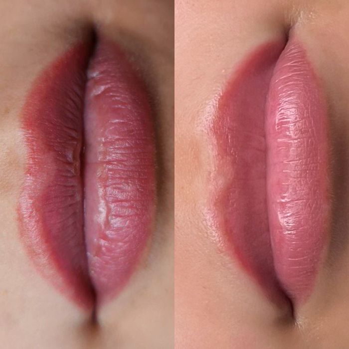 Удаление тату и татуаж