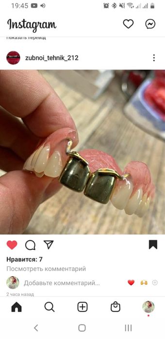 Изготовление сьемных протезов