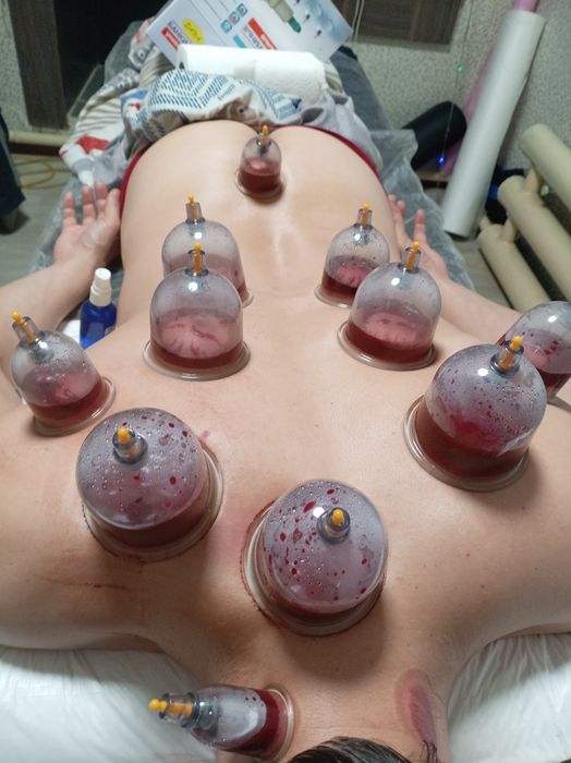 Массаж и хиджама