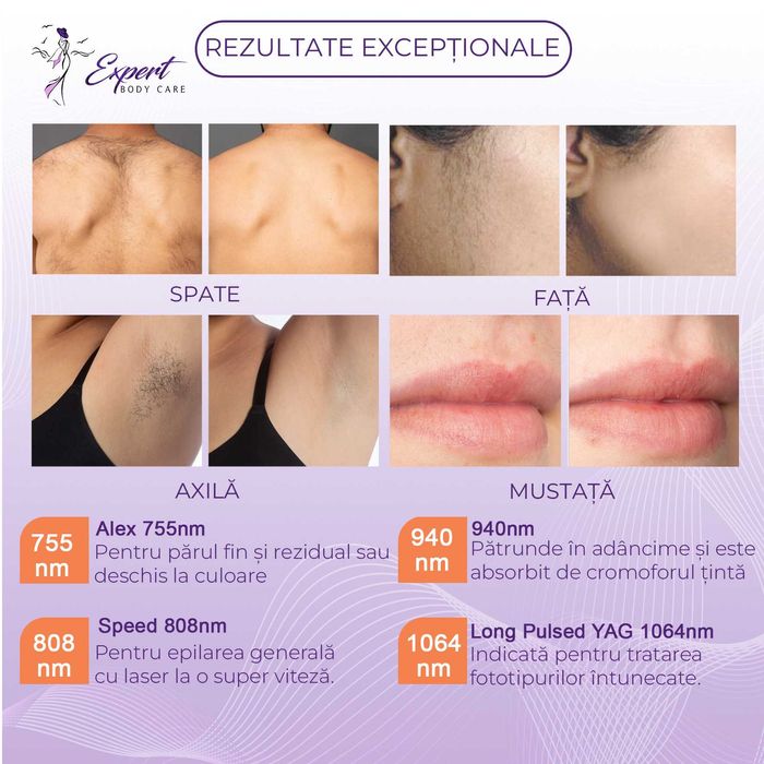 Epilare Definitiva Laser Iasi FEMEI Full Body 6 sed 1990 RON