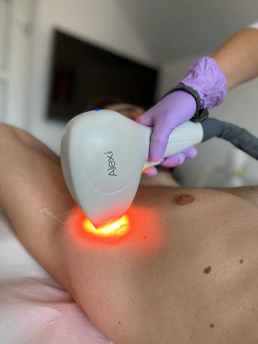 PrimeLase HR Excellence – Laser profesional Epilare Definitivă