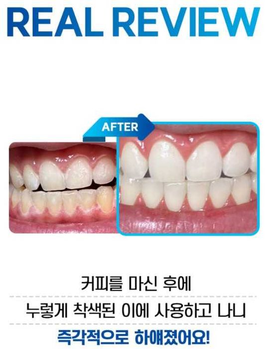 Отбеливатель зубов BRIALL