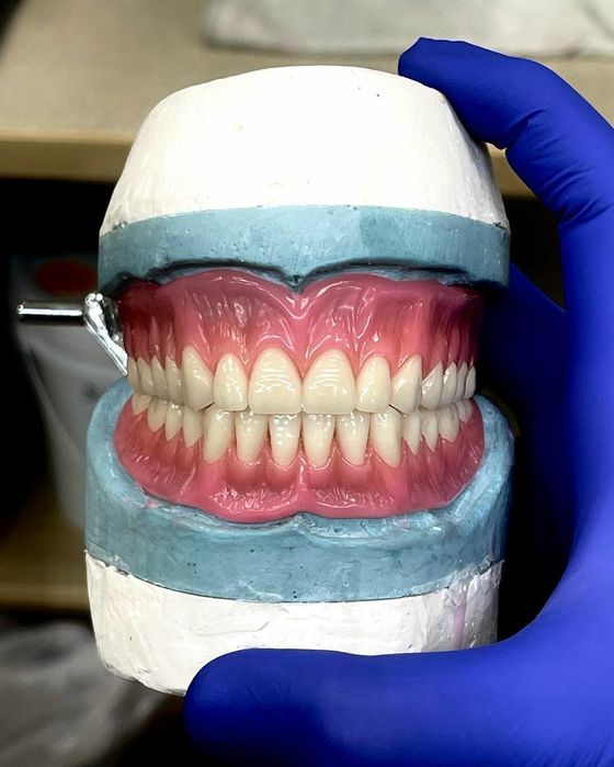 Съёмные протезы,зубные протезы,починки ремонт протеза