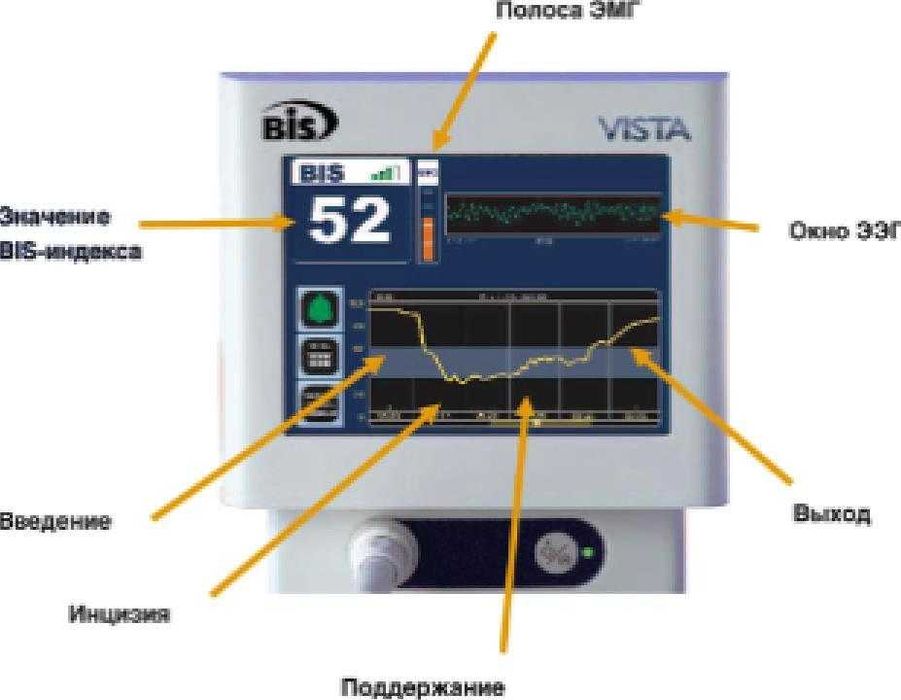 Монитор пациента. Aspect BIS Vista.