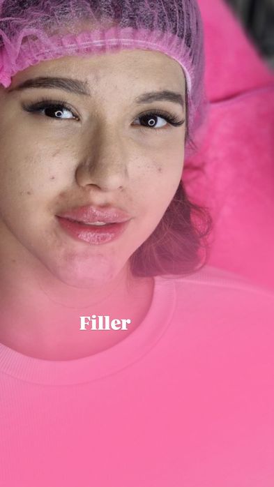 Нитевой сангапури