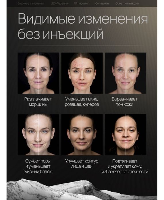 Аппарат для лифтинга лица