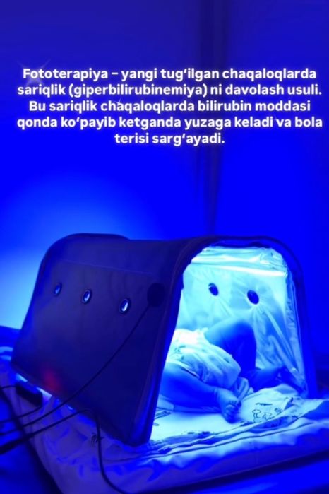 Fotolampa arendasi Navoiy shaxri da endi KUCHAGA  CHIQMASDAN UYDA olin