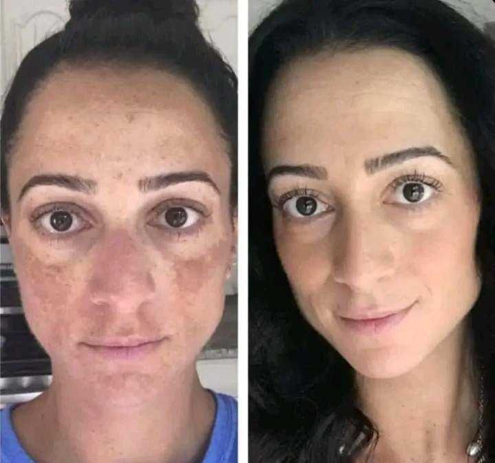 Крем за лице против бръчки и пигментни петна