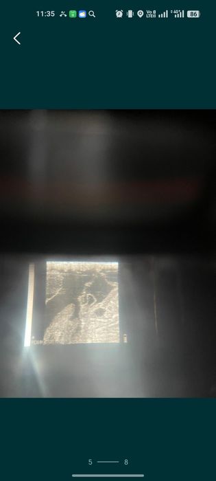 УЗИ для животных лошадей и коровы