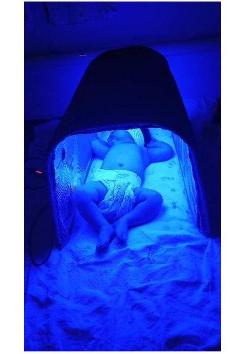 Фотолампа от Желтухи