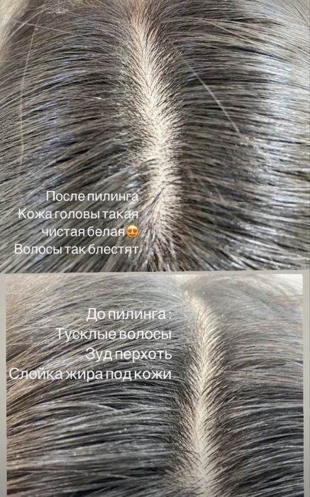 Кератин,Ботокс, Пилинг АКЦИЯ