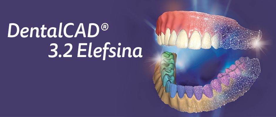 Exocad 3.2 установка