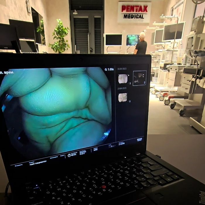 Эндофото и эндовидео документирование | Фото и видеозахват