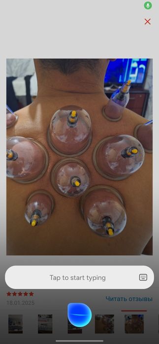 Банки вакуумные, лечебные