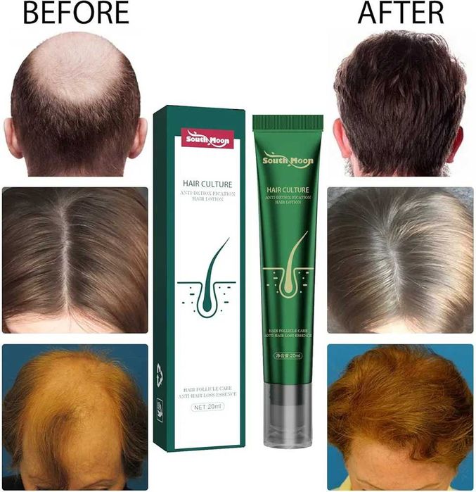 ПРОМО ЦЕНА! Серум против косопад, 20мл