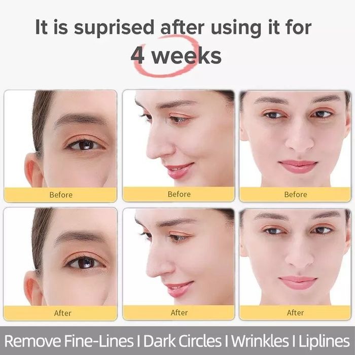 Xiaomi Inface Массажёр для глаз и лица