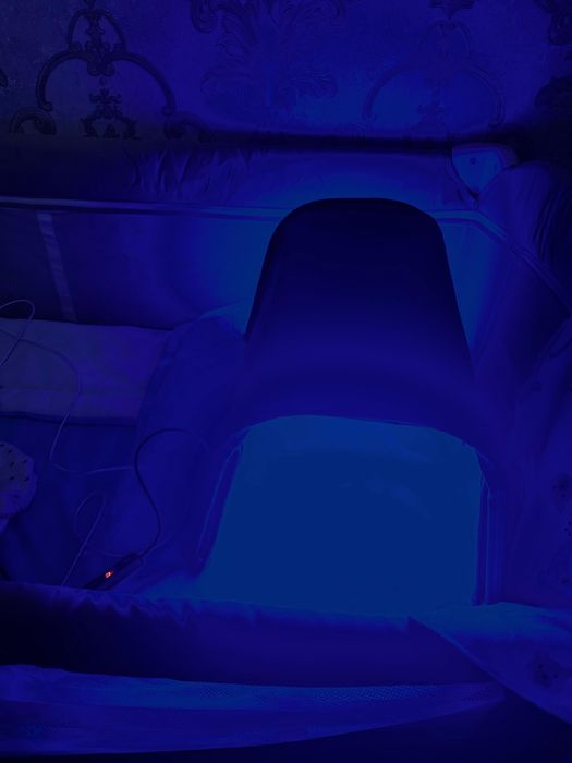 Лампа от желтушки