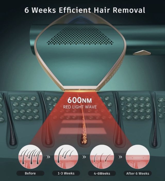 Лазерна епилация LUBEX