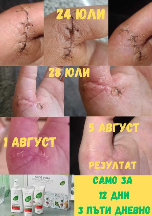 Aloe Vera Комплект за бърза грижа при раздразнена кожа