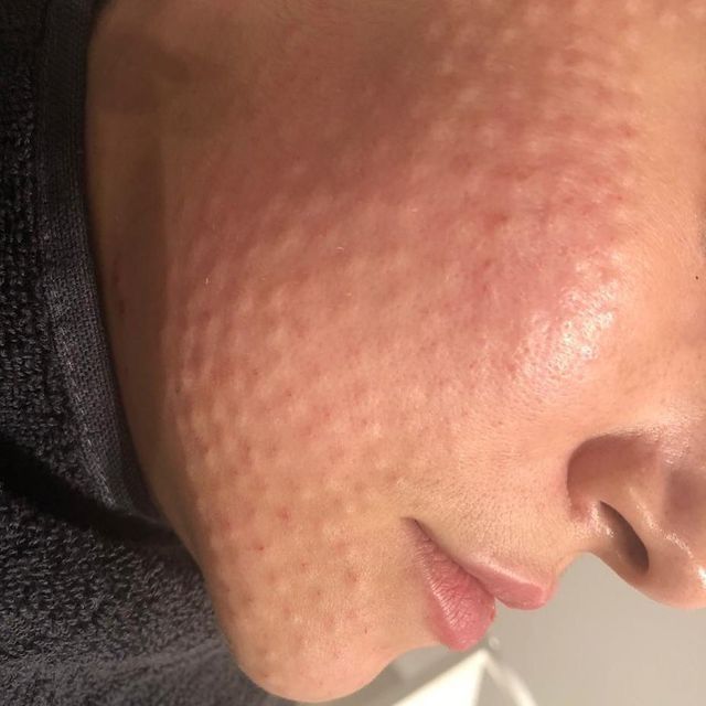 Услуги косметолога эстетиста! Все виды процедур