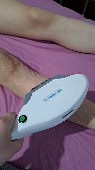 Aparat laser SHR epilare definitiva