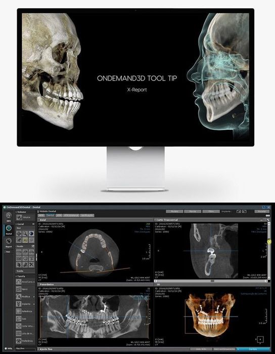 3D Dentri Ecoх –от HDX WILL 35 000$