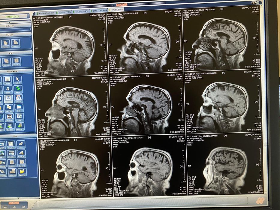 Wandong Open MRI 0.36Tesla (МРТ 0.36T) 2008 Год