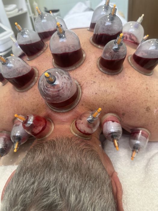 Хиджама в районе 45 квартала