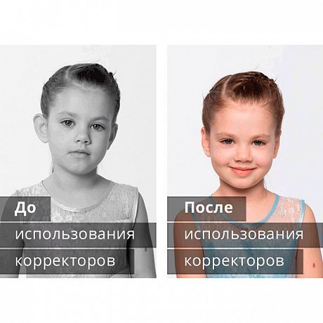 корректоры для ушей у новорожденных и у взрослых исправление форм