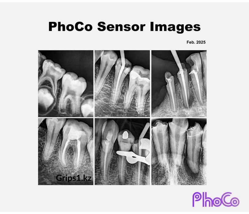 Визиограф PhoCo Mini - сенсор с AI модулем. Радиовизиограф