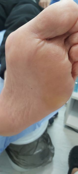 Pedichiura Kart Oradea