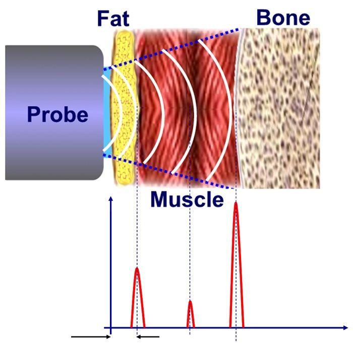 Analizator grasime corporala profesional  ultrasunete BodyMetrix pentru cabinete de nutritie