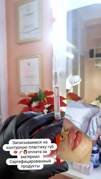 Увеличение губ Косметолог