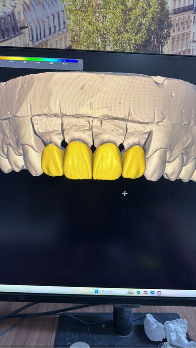Моделировщик Exo Cad (удаленно) Зубной техник