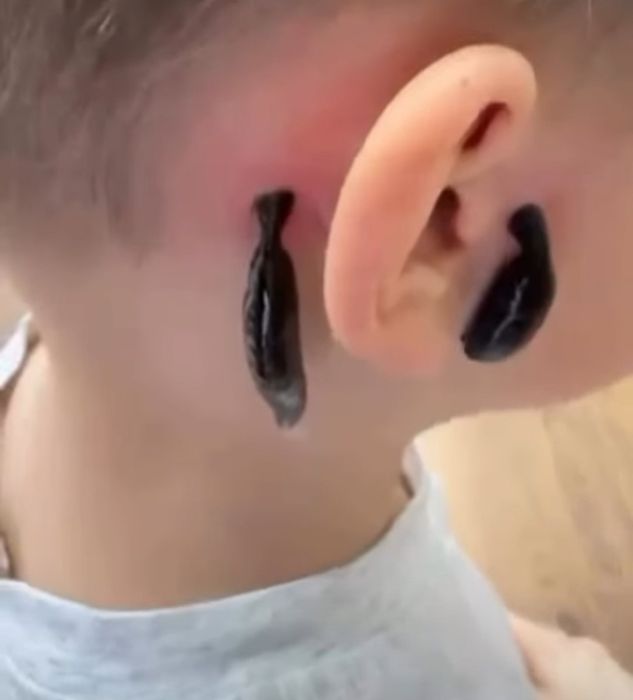 Xijoma v Zuluk muolaja xizmati
