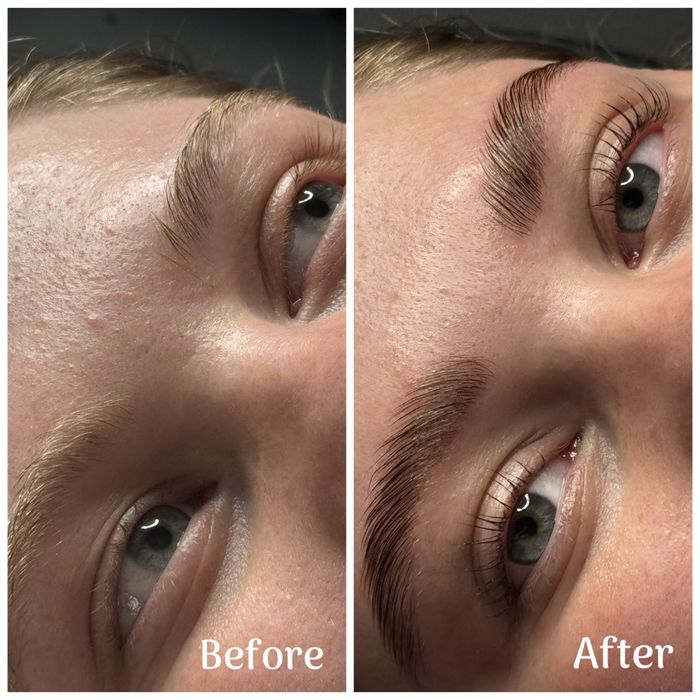 Laminare gene si sprancene