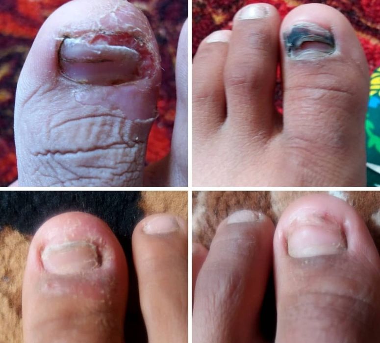 Қара сақар сабын