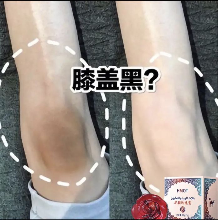 Отбеливающий мыло hmot