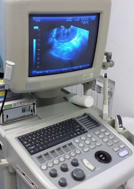 УЗИ сканер SonoAce-8000 (Medison)