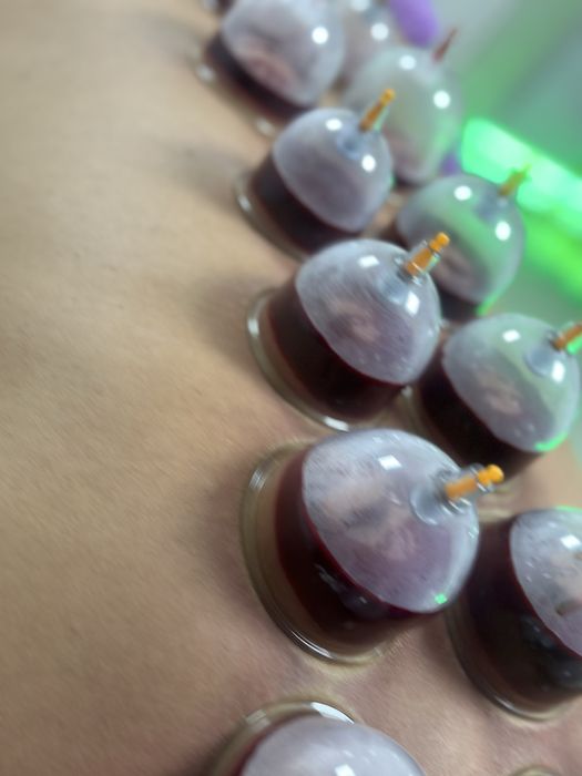 Оздоровительная хиджама