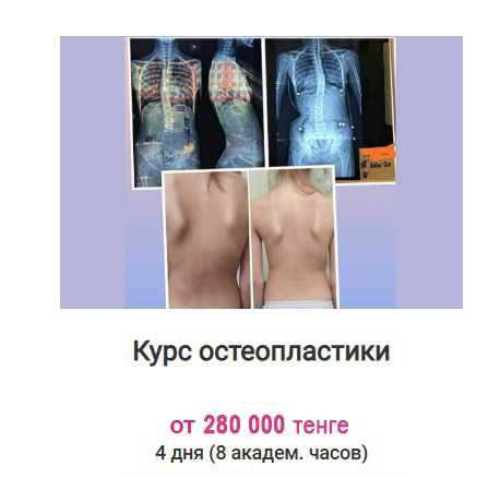 Курс остеопластики в Астане