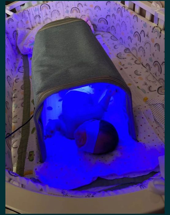 Лампа от желтухи