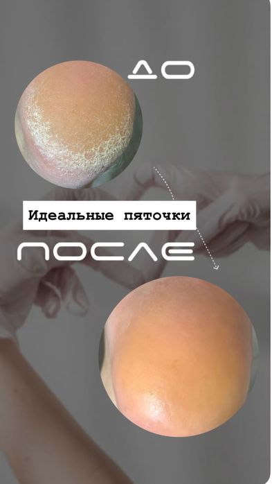 Мастер педикюра-подолог