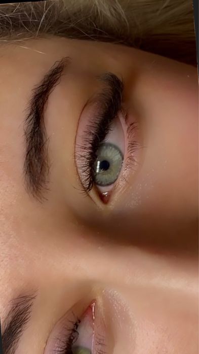 Extensii gene/Laminare