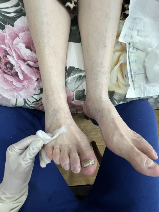 сложный педикюр