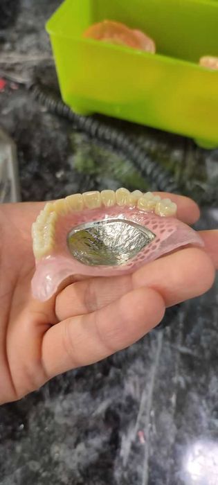 зубные протезы с гарантией